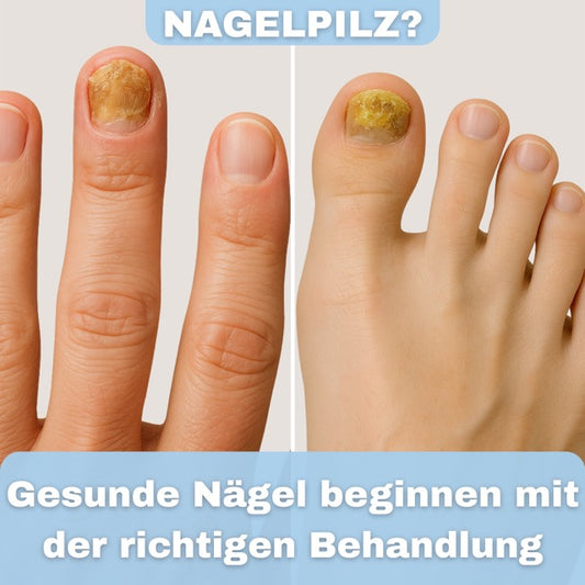 Nagelpilz Stift - 4ml