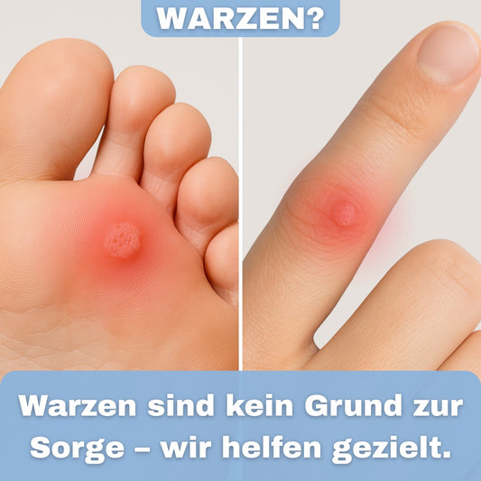 Warzen Tinktur - 2x2ml